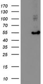 HARS2 Antibody in Western Blot (WB)