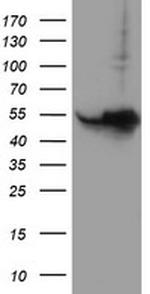HARS2 Antibody in Western Blot (WB)