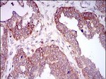 HAS2 Antibody in Immunohistochemistry (Paraffin) (IHC (P))