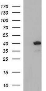 HAUS7 Antibody in Western Blot (WB)