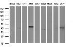 HAUS7 Antibody in Western Blot (WB)