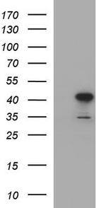 HAUS7 Antibody in Western Blot (WB)