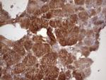 HAVCR2 Antibody in Immunohistochemistry (Paraffin) (IHC (P))