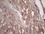 HAVCR2 Antibody in Immunohistochemistry (Paraffin) (IHC (P))