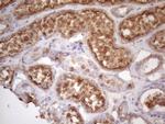 HAVCR2 Antibody in Immunohistochemistry (Paraffin) (IHC (P))