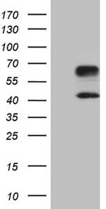 HAVCR2 Antibody in Western Blot (WB)