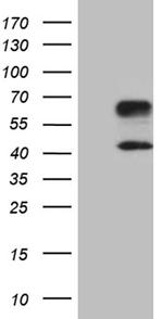 HAVCR2 Antibody in Western Blot (WB)