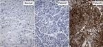 HBsAg Antibody in Immunohistochemistry (Paraffin) (IHC (P))