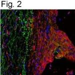 ITIH1 Antibody in Immunohistochemistry (Paraffin) (IHC (P))