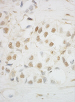 HCA66 Antibody in Immunohistochemistry (IHC)