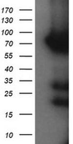 HCFC2 Antibody in Western Blot (WB)