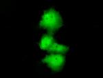 HDAC10 Antibody in Immunocytochemistry (ICC/IF)