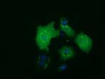 HDAC10 Antibody in Immunocytochemistry (ICC/IF)