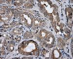 HDAC10 Antibody in Immunohistochemistry (Paraffin) (IHC (P))