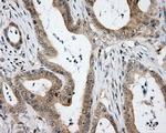 HDAC10 Antibody in Immunohistochemistry (Paraffin) (IHC (P))