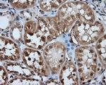 HDAC10 Antibody in Immunohistochemistry (Paraffin) (IHC (P))