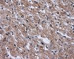 HDAC10 Antibody in Immunohistochemistry (Paraffin) (IHC (P))