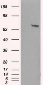 HDAC10 Antibody in Western Blot (WB)