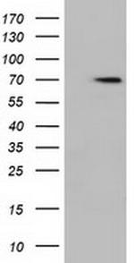 HDAC10 Antibody in Western Blot (WB)