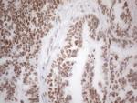 HDAC2 Antibody in Immunohistochemistry (Paraffin) (IHC (P))