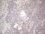 HDAC2 Antibody in Immunohistochemistry (Paraffin) (IHC (P))