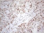 HDAC2 Antibody in Immunohistochemistry (Paraffin) (IHC (P))