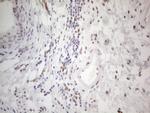 HDAC2 Antibody in Immunohistochemistry (Paraffin) (IHC (P))