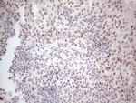 HDAC2 Antibody in Immunohistochemistry (Paraffin) (IHC (P))