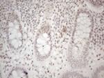 HDAC2 Antibody in Immunohistochemistry (Paraffin) (IHC (P))