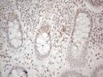 HDAC2 Antibody in Immunohistochemistry (Paraffin) (IHC (P))