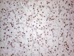 HDAC2 Antibody in Immunohistochemistry (Paraffin) (IHC (P))