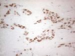 HDAC2 Antibody in Immunohistochemistry (Paraffin) (IHC (P))