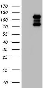 HDAC4 Antibody in Western Blot (WB)