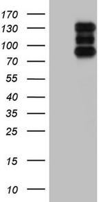 HDAC4 Antibody in Western Blot (WB)