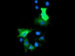 HDAC6 Antibody in Immunocytochemistry (ICC/IF)