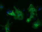 HDAC6 Antibody in Immunocytochemistry (ICC/IF)