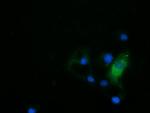 HDAC6 Antibody in Immunocytochemistry (ICC/IF)