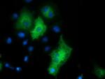 HDAC6 Antibody in Immunocytochemistry (ICC/IF)