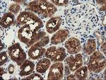 HDAC6 Antibody in Immunohistochemistry (Paraffin) (IHC (P))