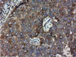 HDAC6 Antibody in Immunohistochemistry (Paraffin) (IHC (P))