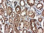 HDAC6 Antibody in Immunohistochemistry (Paraffin) (IHC (P))