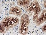 HDAC6 Antibody in Immunohistochemistry (Paraffin) (IHC (P))