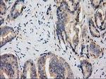 HDAC6 Antibody in Immunohistochemistry (Paraffin) (IHC (P))