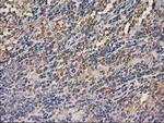 HDAC6 Antibody in Immunohistochemistry (Paraffin) (IHC (P))