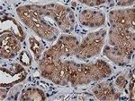 HDAC6 Antibody in Immunohistochemistry (Paraffin) (IHC (P))