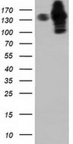 HDAC6 Antibody in Western Blot (WB)