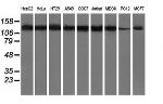 HDAC6 Antibody in Western Blot (WB)