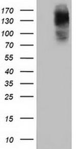 HDAC6 Antibody in Western Blot (WB)