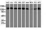 HDAC6 Antibody in Western Blot (WB)