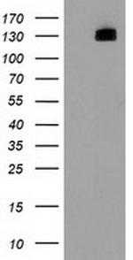 HDAC6 Antibody in Western Blot (WB)